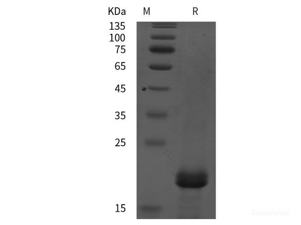 Human TRAPPC6A/TPC6A Recombinant Protein (His tag) Human TRAPPC6A/TPC6A Recombinant Protein (His tag)