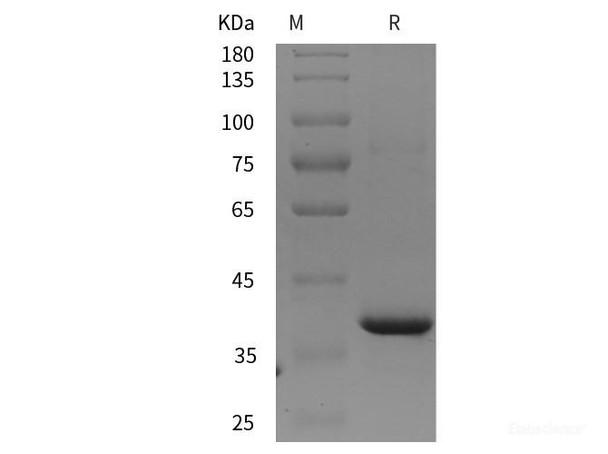 Human MMP-2/CLG4A Recombinant Protein (His tag) (RPES5544)