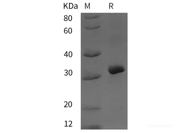 Human ABCG2 Recombinant Protein (His tag)