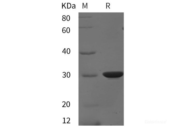 Mouse BCR Recombinant Protein (His tag) Mouse BCR Recombinant Protein (His tag)