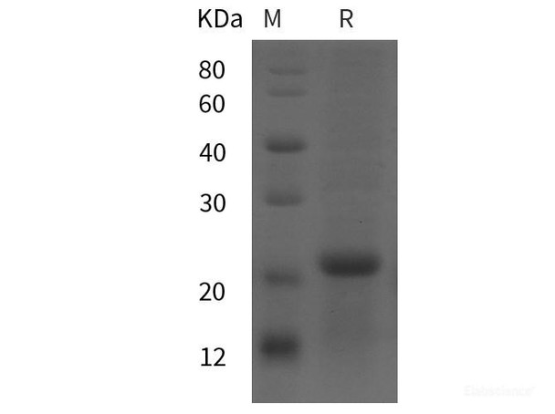 Rat CRH Recombinant Protein (His tag)