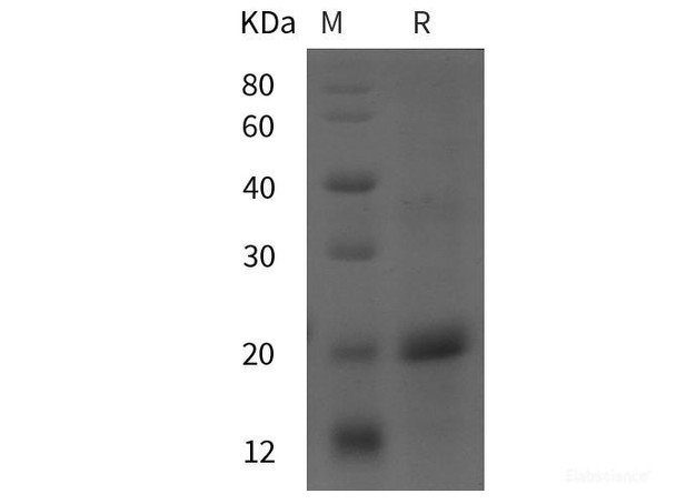 Rat MCP-1 Recombinant Protein (His tag)