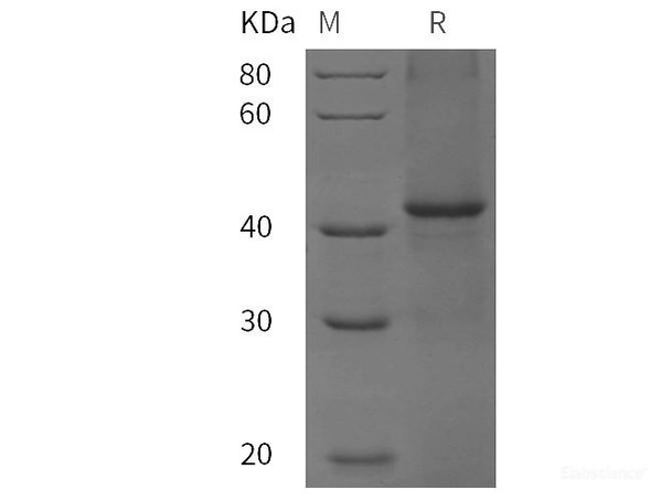 Rat CD5 / Cluster of Differentiation 5 Recombinant Protein (His tag)