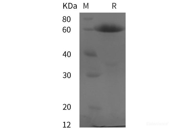 Human Calnexin/CANX Recombinant Protein (His tag) (RPES5992)