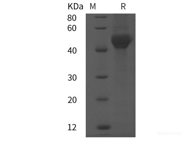 Rat SHBG/ABP Recombinant Protein (His tag)