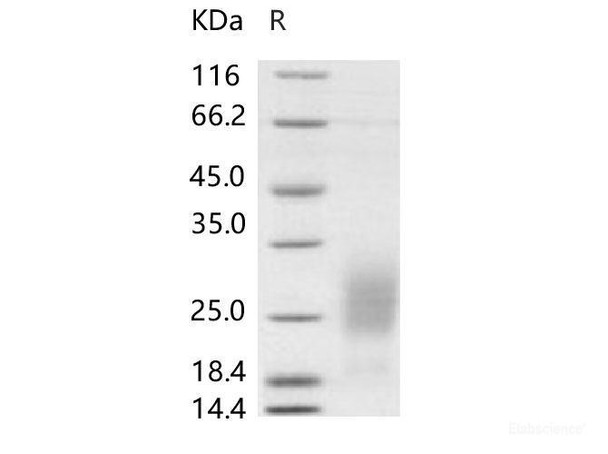 Human GM-CSF Recombinant Protein (HEK293 Cells) (His Tag) (Active)