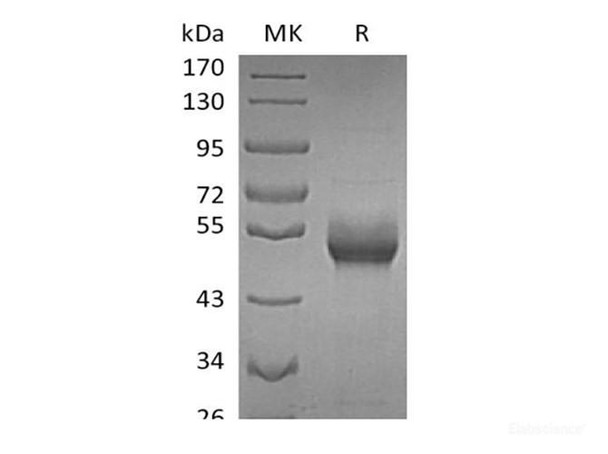 Recombinant Human B4GALT1 (C-6His)