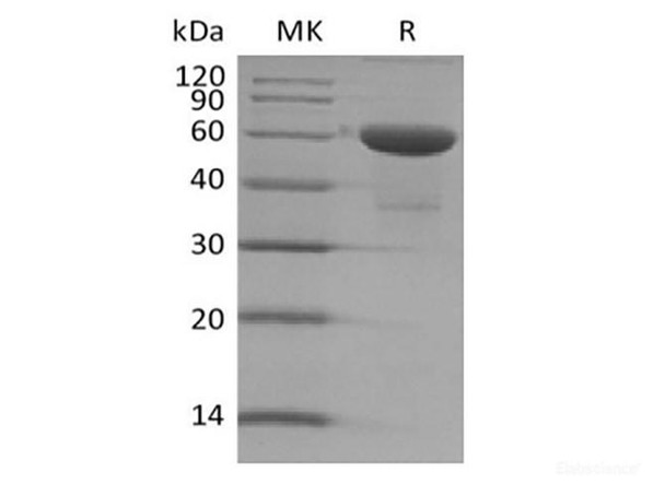 Recombinant Human TMED1 (C-Fc)