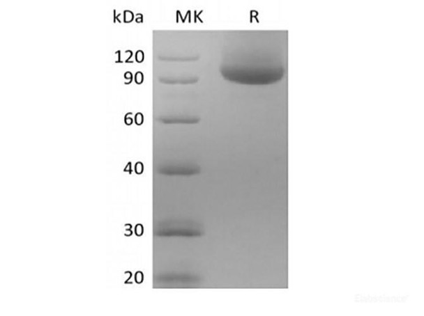 Recombinant Human Neuropilin-1/NRP1 (C-Avi-6His) Biotinylated