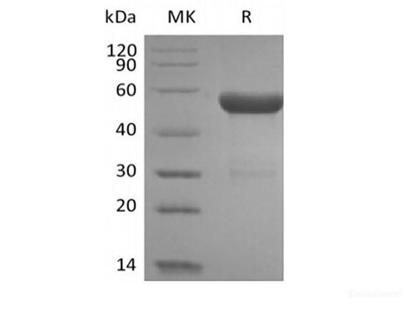 Human HLA-A*0201 HPV16 E7 complex Recombinant Protein (C-10His)