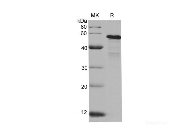 Human pan-AKT Recombinant Protein (His Tag) (RPES6510)