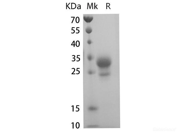 Human IL-29 Recombinant Protein (RPES6540)