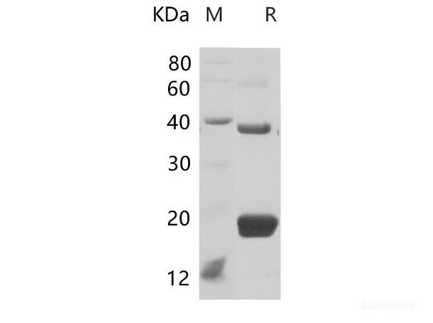 Mouse TIMP1 Recombinant Protein (His Tag) (RPES6624)