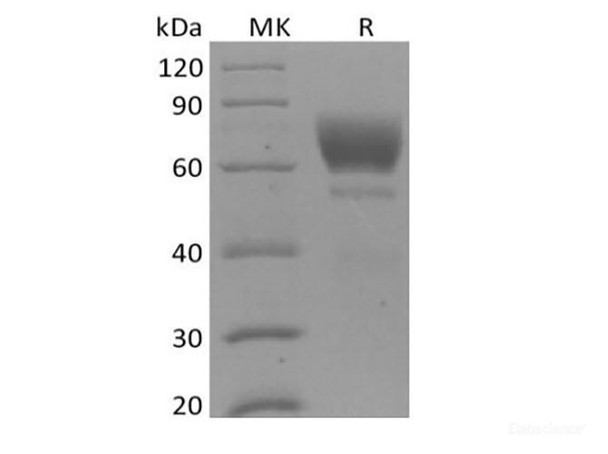 Mouse Tyrosine-Recombinant Protein kinase receptor UFO/AXL oncogene/UFO (C-6His)