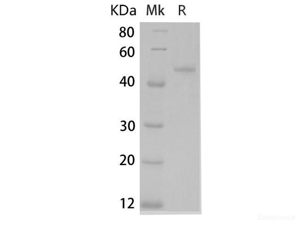 Mouse IL-12B (p40) Recombinant Protein (RPES6756)