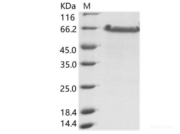 EBOV (Sudan ebolavirus, strain Gulu) NucleoRecombinant Protein / NP (aa361-aa738) Recombinant Protein (His Tag)