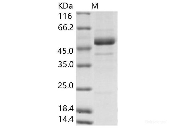 Rift Valley fever virus (RVFV) (strain MP12) glycoRecombinant Protein / G2 Recombinant Protein (His Tag)