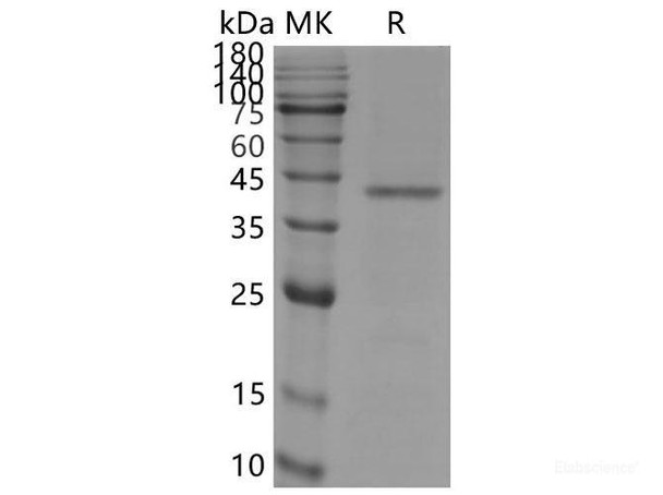 SARS-CoV-2 S+E+M Recombinant Protein