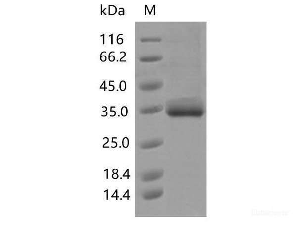 Recombinant SARS-CoV-2 Spike RBD (V483I) (His Tag)