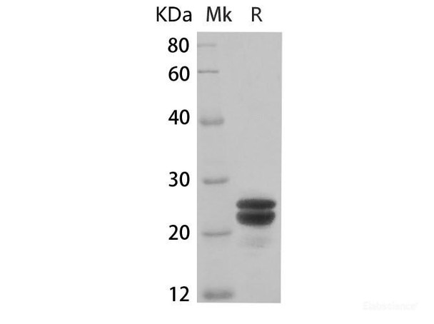 2019-nCoV E Recombinant Protein (RPES7197)