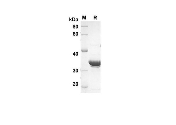 Recombinant Human G-CSF Protein(Trx Tag) (RPES8023)