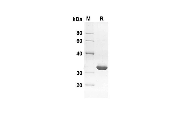 Recombinant Human PFN1 Protein(Sumo Tag) (RPES8030)