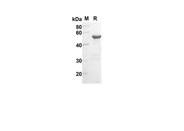 Recombinant Human IVL Protein(Gst Tag) (RPES8039)
