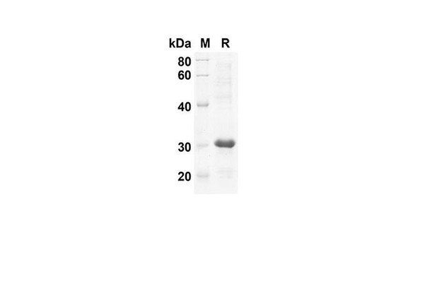 Recombinant Human CCL19 Protein(Sumo Tag) (RPES8042)