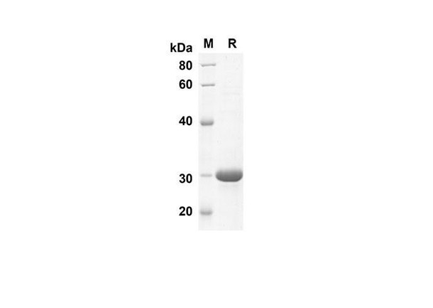 Recombinant Human S100A1 Protein(Sumo Tag) (RPES8067)