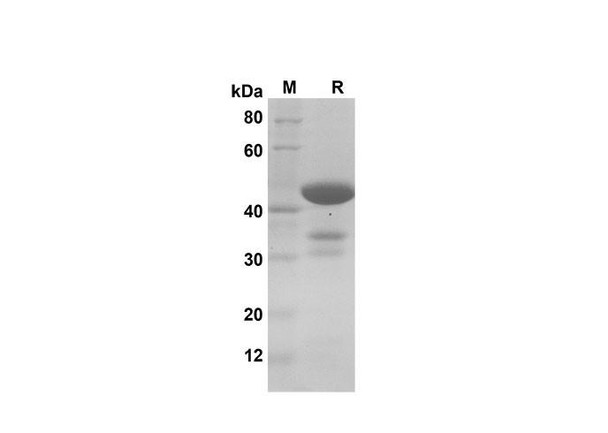 Recombinant Human PFN1 Protein(Gst Tag) (RPES8095)