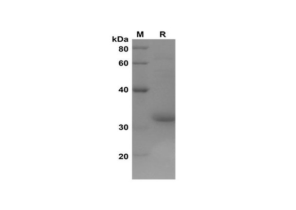 Recombinant Human ACSL4 Protein(Trx Tag) (RPES8119)