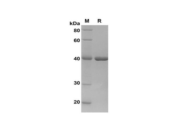 Recombinant Human STAT3 APRF Protein(Sumo Tag) (RPES8126)