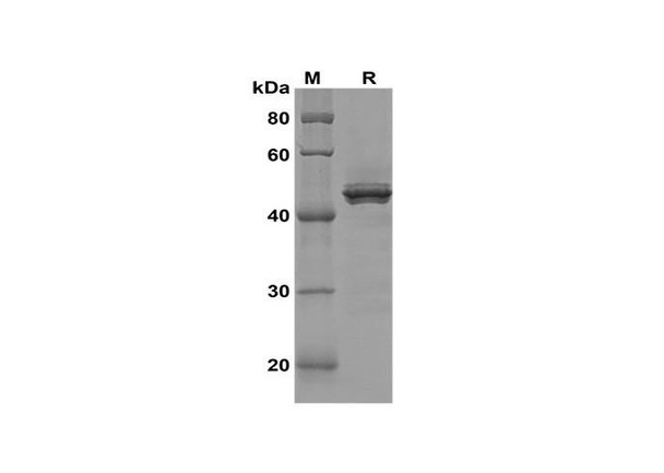 Recombinant Human ERG Protein(Sumo Tag) (RPES8143)