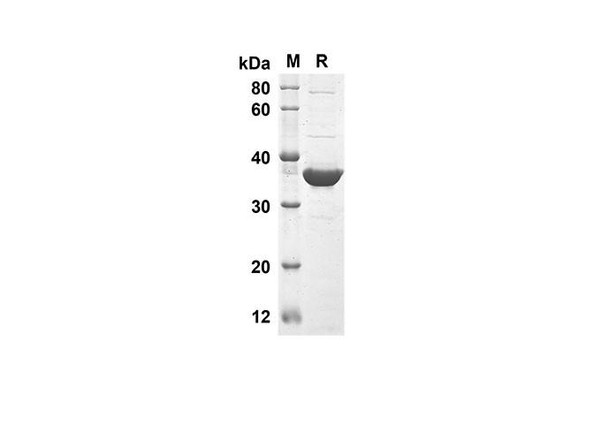 Recombinant Mouse TNFSF10 Protein(Trx Tag) (RPES8157)