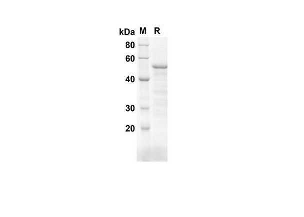 Recombinant Mouse CD34 Protein(Trx Tag) (RPES8168)