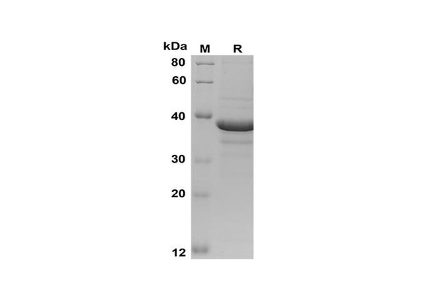 Recombinant Mouse GH Protein(Trx Tag) (RPES8176)