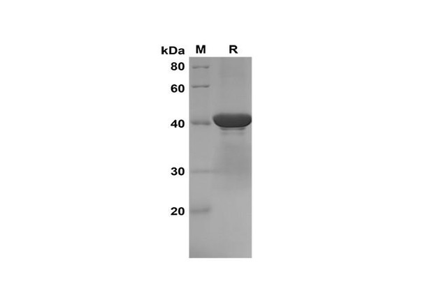 Recombinant Mouse Cystatin C Protein(Gst Tag) (RPES8180)
