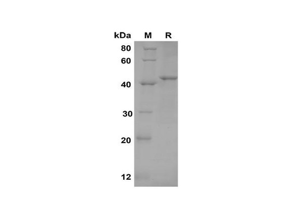 Recombinant Mouse TNF RI/TNFRSF1A Protein(Gst Tag) (RPES8182)