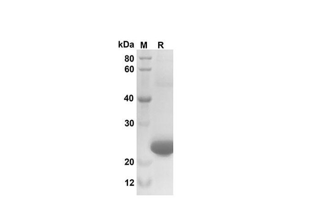 Recombinant Mouse CXCL3/CINC-2Â±/Â² Protein(Sumo Tag) (RPES8191)