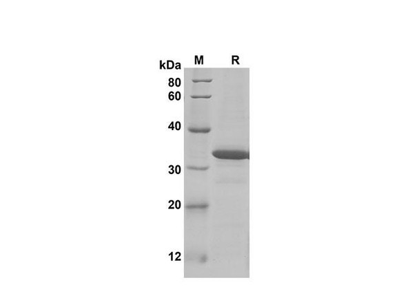 Recombinant Mouse CCL9/10/MIP-1Â³ Protein(Trx Tag) (RPES8212)