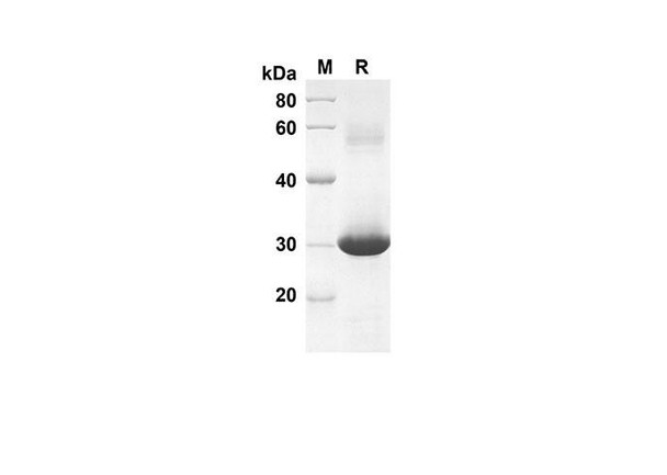 Recombinant Rat CXCL3 Protein(Trx Tag) (RPES8226)