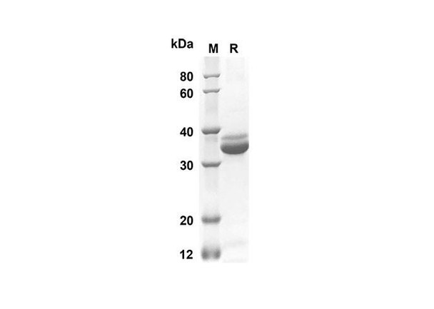 Recombinant Rat IL-10 Protein(Trx Tag) (RPES8230)