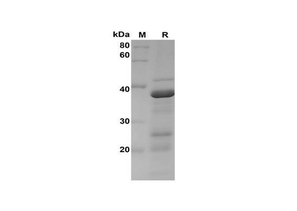 Recombinant Rat BCL2 Protein(Sumo Tag) (RPES8240)
