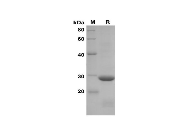 Recombinant Rat CXCL5/LIX Protein(Sumo Tag) (RPES8244)