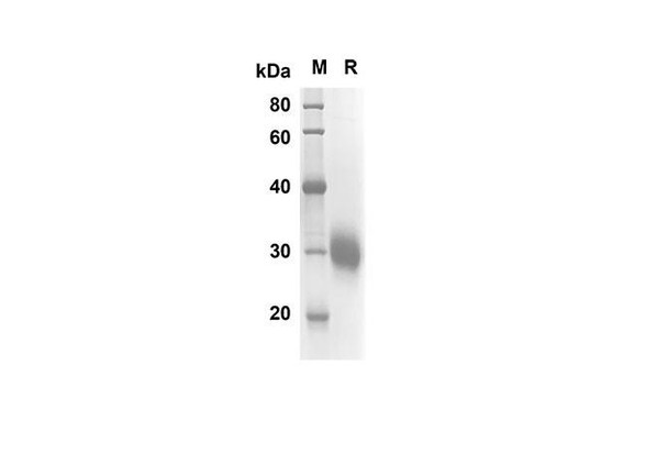 Recombinant Human FCGR2A Protein(His Tag) (RPES8272)