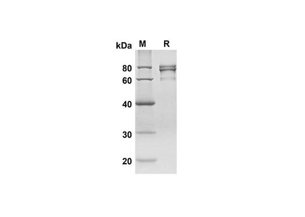Recombinant Human CA9 Protein( Fc Tag) (RPES8283)