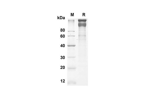 Recombinant Human LEPR Protein (His Tag) (RPES8306)