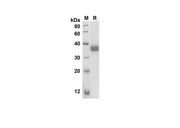 Recombinant Human CD274 Protein (His Tag) (RPES8309)