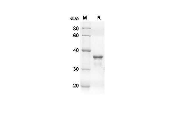 Recombinant human TARC Protein (Fc Tag) (RPES8313)
