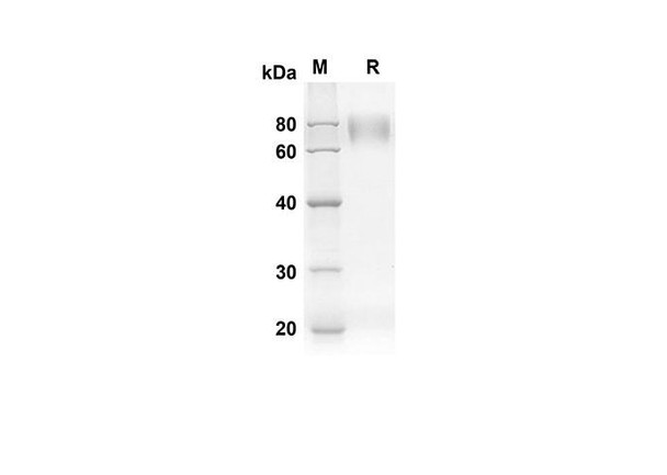 Recombinant Human CD80 Protein (Fc Tag) (RPES8318)